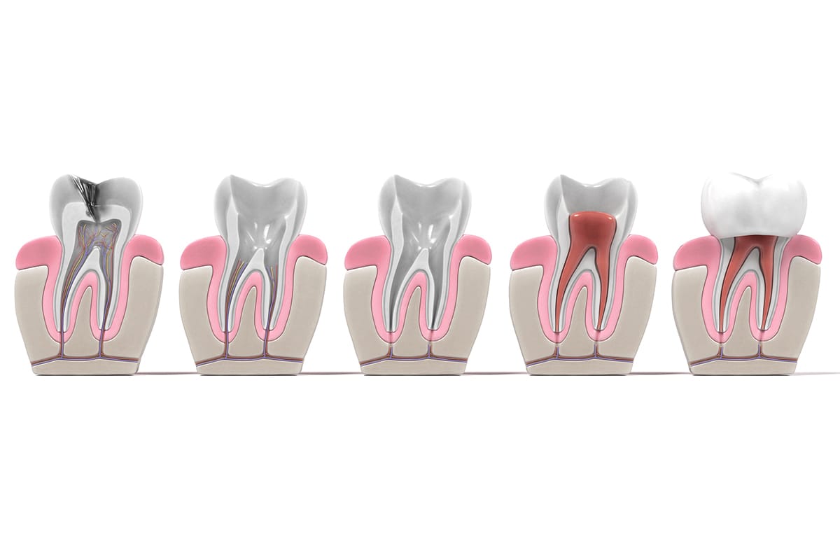 Cda Endodoncia01