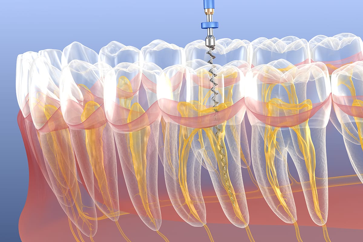 Cda Endodoncia02